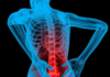 The Major Factors that Cause Back Injuries in the Workplace