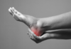 Which Type of Doctor Treats Heel Pain in Atlanta, GA