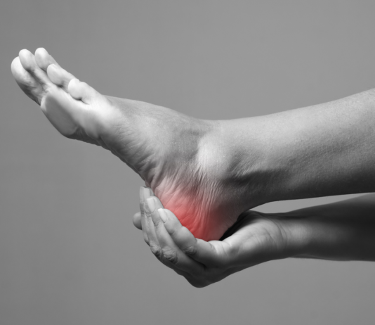 Which Type of Doctor Treats Heel Pain in Atlanta, GA
