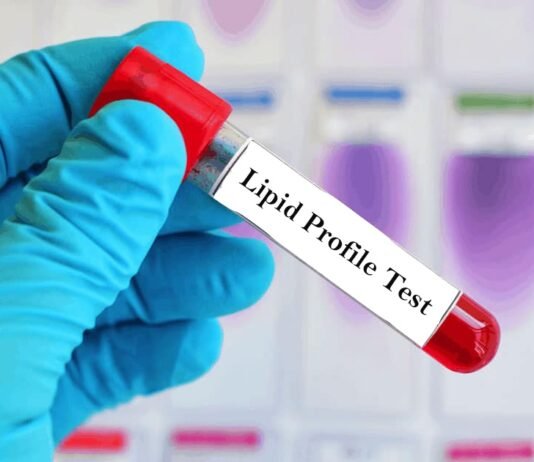 Normal Range for Lipid Profile Test